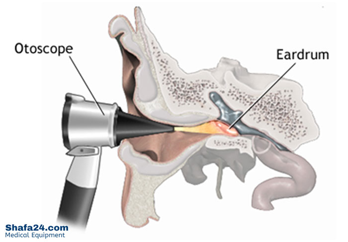 انواع اتوسکوپ - شفا24