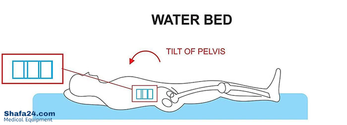 تشک مواج آبی - شفا24