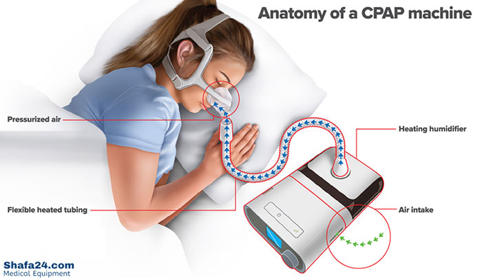 سی پپ - شفا24