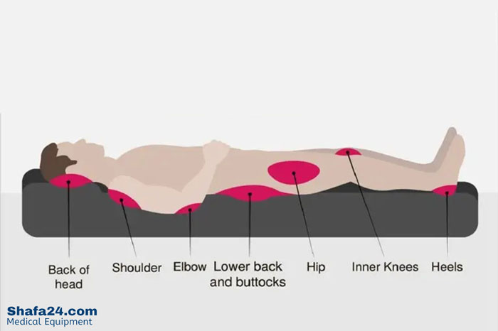 تشک مخصوص زخم بستر - شفا24