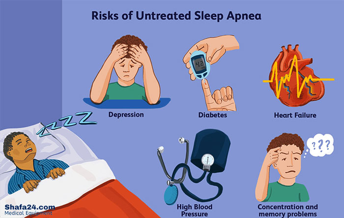 آپنه خواب - شفا24