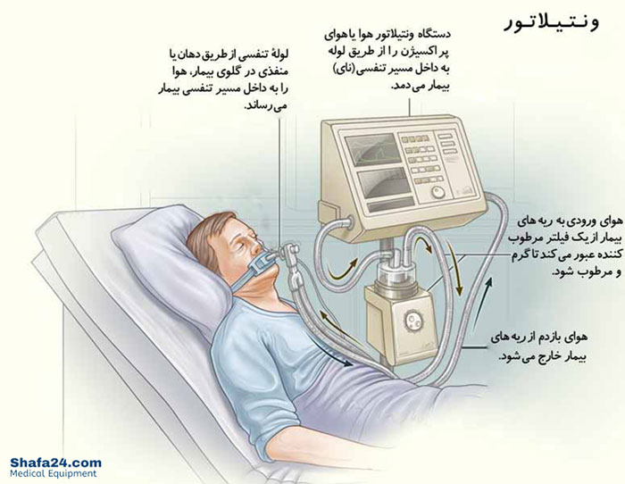 ونتیلاتور یا دستگاه تنفس مصنوعی - شفا24