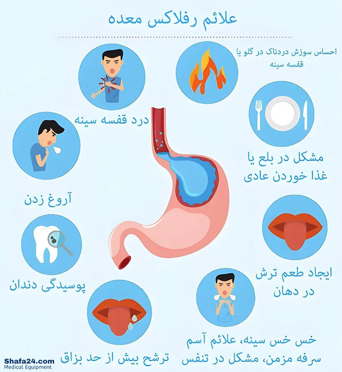 رفلاکس معده - شفا24