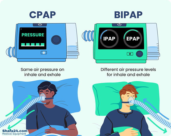 دستگاه Bipap - شفا24