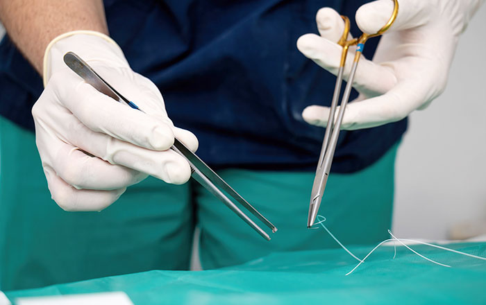 بخیه جراحی - شفا24