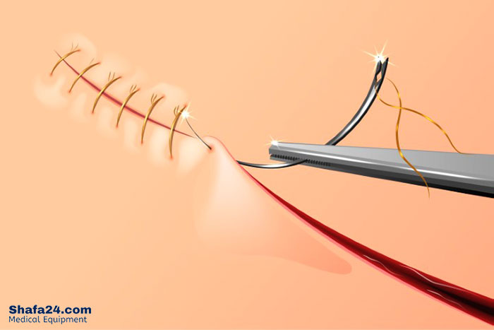 بخیه جراحی - شفا24