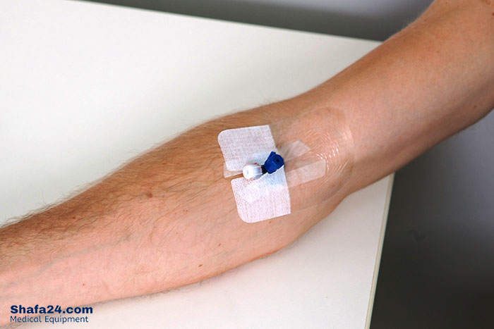 روش استفاده از آنژیوکت - شفا24