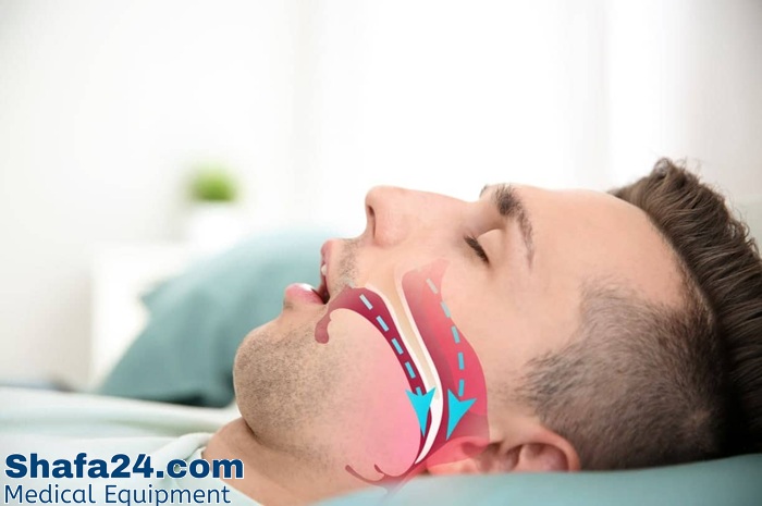 عملکرد دستگاه CPAP چگونه است؟