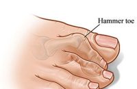 لاانگشتی همرتو طب و صنعت مدل 10800 - شفا24